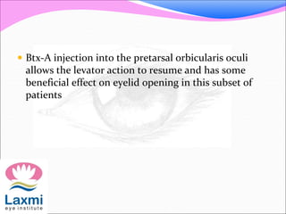  Btx-A injection into the pretarsal orbicularis oculi
allows the levator action to resume and has some
beneficial effect on eyelid opening in this subset of
patients
 