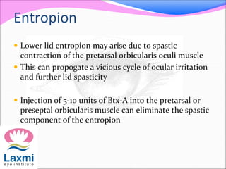 Entropion
 Lower lid entropion may arise due to spastic
contraction of the pretarsal orbicularis oculi muscle
 This can propogate a vicious cycle of ocular irritation
and further lid spasticity
 Injection of 5-10 units of Btx-A into the pretarsal or
preseptal orbicularis muscle can eliminate the spastic
component of the entropion
 