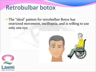 Retrobulbar botox
 The "ideal" patient for retrobulbar Botox has
restricted movement, oscillopsia, and is willing to use
only one eye.
 