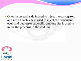  One site on each side is used to inject the corrugator,
one site on each side is used to inject the orbicularis
oculi and depressor supercilii, and one site is used to
inject the procerus in the mid line.
 