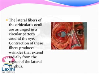  The lateral fibers of
the orbicularis oculi
are arranged in a
circular pattern
around the eye.
Contraction of these
fibers produces
wrinkles that extend
radially from the
region of the lateral
canthus.
 