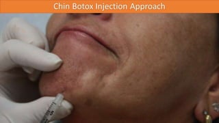 ADVANCED BOTOX COURSE.PART II. HOW TO INJECT BOTOX SAFELY?