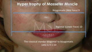 ADVANCED BOTOX COURSE.PART II. HOW TO INJECT BOTOX SAFELY?