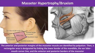 ADVANCED BOTOX COURSE.PART II. HOW TO INJECT BOTOX SAFELY?