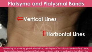 ADVANCED BOTOX COURSE.PART II. HOW TO INJECT BOTOX SAFELY?