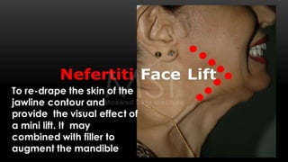 ADVANCED BOTOX COURSE.PART II. HOW TO INJECT BOTOX SAFELY?