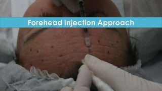ADVANCED BOTOX COURSE.PART II. HOW TO INJECT BOTOX SAFELY?