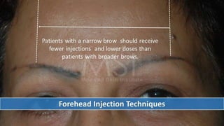ADVANCED BOTOX COURSE.PART II. HOW TO INJECT BOTOX SAFELY?