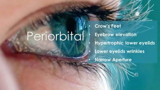 ADVANCED BOTOX COURSE.PART II. HOW TO INJECT BOTOX SAFELY?