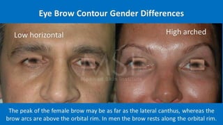 ADVANCED BOTOX COURSE.PART II. HOW TO INJECT BOTOX SAFELY?