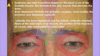 ADVANCED BOTOX COURSE.PART II. HOW TO INJECT BOTOX SAFELY?