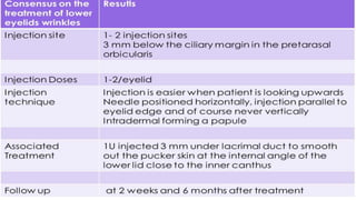 ADVANCED BOTOX COURSE.PART II. HOW TO INJECT BOTOX SAFELY?