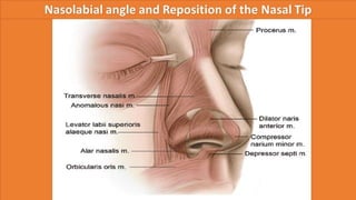 ADVANCED BOTOX COURSE.PART II. HOW TO INJECT BOTOX SAFELY?