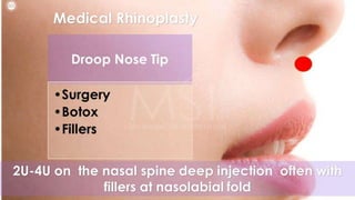 ADVANCED BOTOX COURSE.PART II. HOW TO INJECT BOTOX SAFELY?