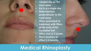 ADVANCED BOTOX COURSE.PART II. HOW TO INJECT BOTOX SAFELY?