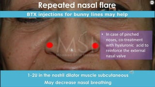 ADVANCED BOTOX COURSE.PART II. HOW TO INJECT BOTOX SAFELY?