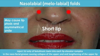 ADVANCED BOTOX COURSE.PART II. HOW TO INJECT BOTOX SAFELY?