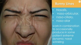 ADVANCED BOTOX COURSE.PART II. HOW TO INJECT BOTOX SAFELY?