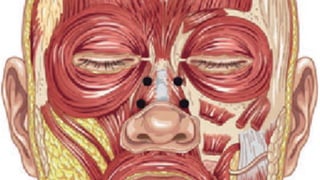 ADVANCED BOTOX COURSE.PART II. HOW TO INJECT BOTOX SAFELY?