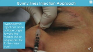 ADVANCED BOTOX COURSE.PART II. HOW TO INJECT BOTOX SAFELY?
