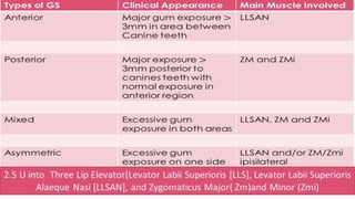 ADVANCED BOTOX COURSE.PART II. HOW TO INJECT BOTOX SAFELY?