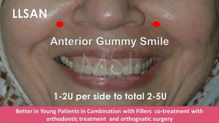 ADVANCED BOTOX COURSE.PART II. HOW TO INJECT BOTOX SAFELY?