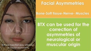 ADVANCED BOTOX COURSE.PART II. HOW TO INJECT BOTOX SAFELY?