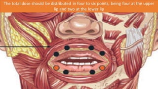 ADVANCED BOTOX COURSE.PART II. HOW TO INJECT BOTOX SAFELY?