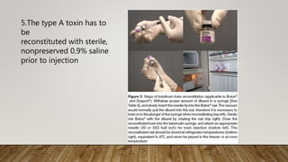 5.The type A toxin has to
be
reconstituted with sterile,
nonpreserved 0.9% saline
prior to injection
 