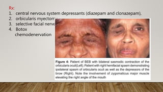 Rx:
1. central nervous system depressants (diazepam and clonazepam),
2. orbicularis myectomy
3. selective facial nerve
4. Botox
chemodenervation
 