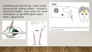 9.Stabilize eye with forcep - slide needle
along muscle orbital surface - muscle is
stretched initially - then allow for some
contraction to get EMG signal. Inject
when signal heard
 