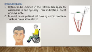 Retrobulbarbotox
1. Botox can be injected in the retrobulbar space for
oscillopsia in one eye only - rare indication - treat
one eye only.
2. In most cases, patient will have systemic problem
such as brain stem stroke.
 
