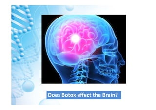 Botox and its effect on the Brain | PDF