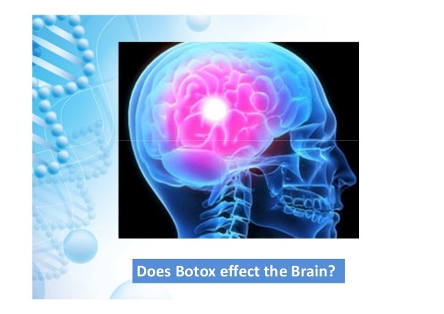 Botox and its effect on the Brain