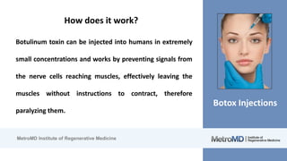 MetroMD Institute of Regenerative Medicine
Botox Injections
How does it work?
Botulinum toxin can be injected into humans in extremely
small concentrations and works by preventing signals from
the nerve cells reaching muscles, effectively leaving the
muscles without instructions to contract, therefore
paralyzing them.
 