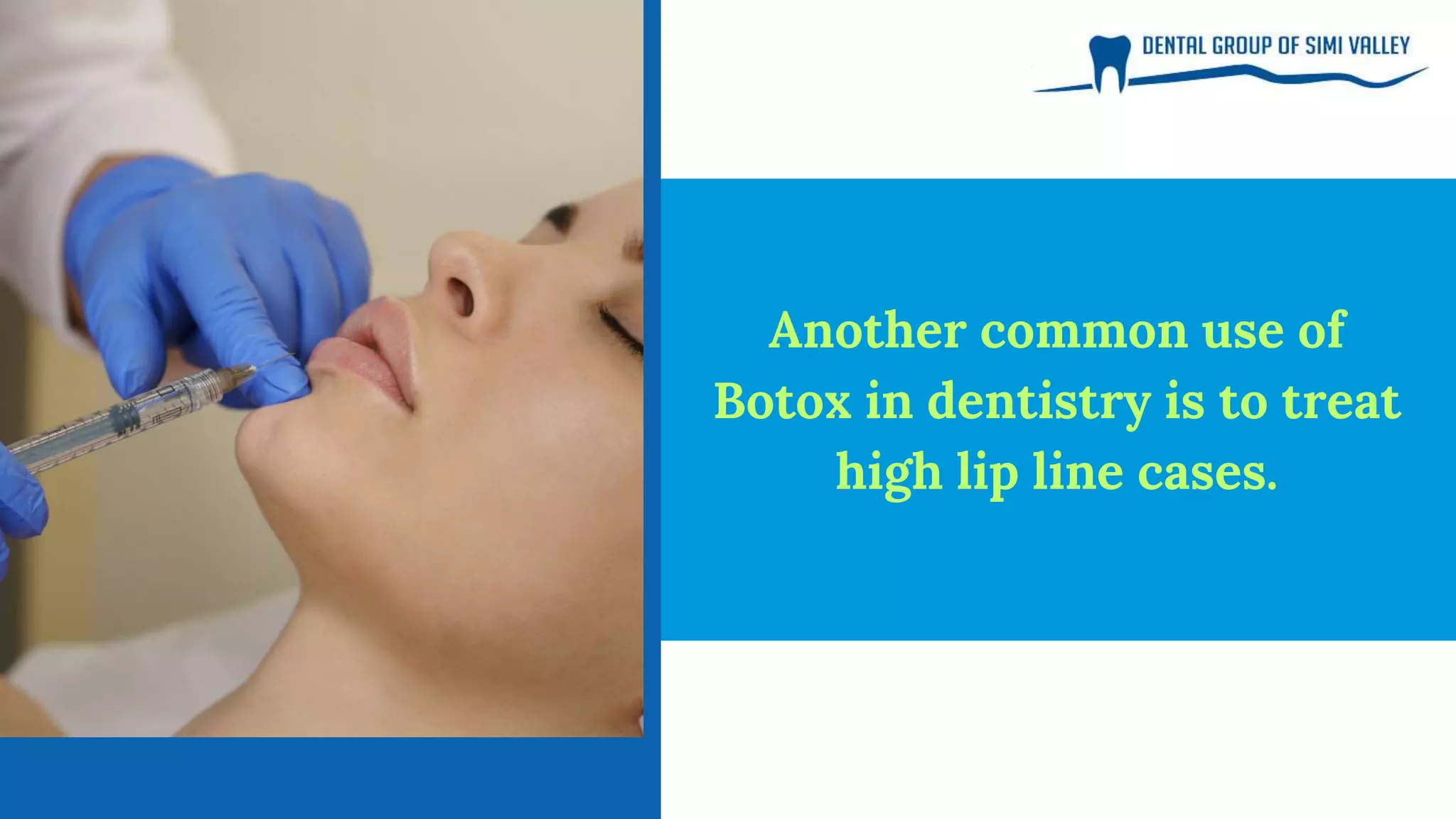 Botox In Dentistry In Simi Valley | PPTX