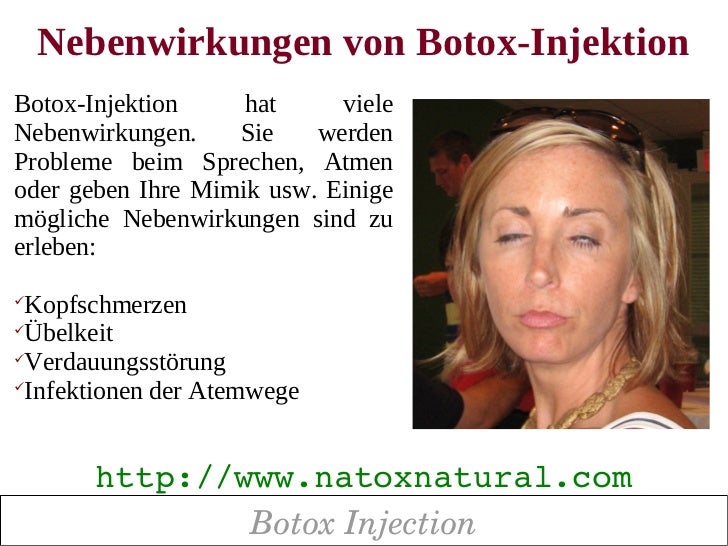 Botox Injection