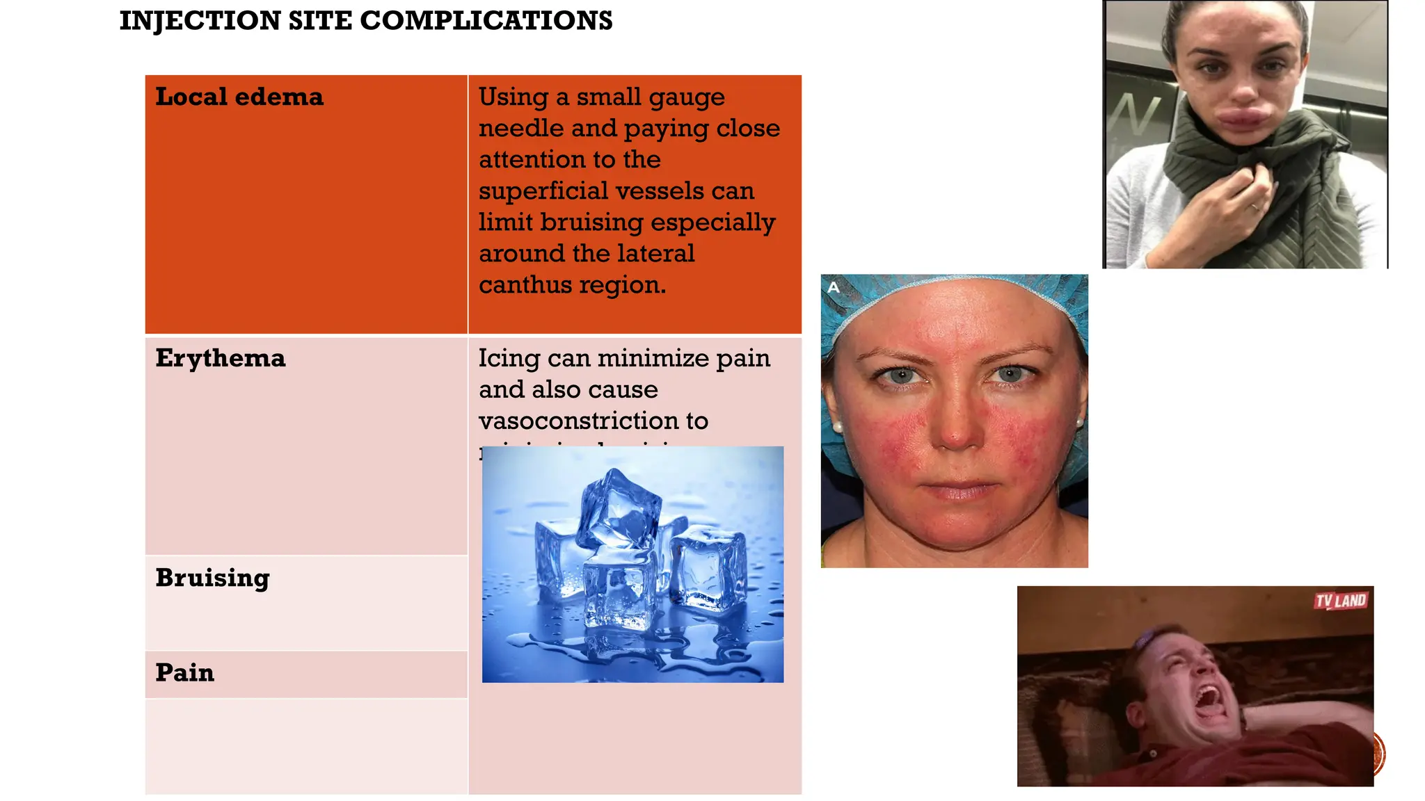 INJECTION SITE COMPLICATIONS
Local edema Using a small gauge
needle and paying close
attention to the
superficial vessels can
limit bruising especially
around the lateral
canthus region.
Erythema Icing can minimize pain
and also cause
vasoconstriction to
minimize bruising
Bruising
Pain
 