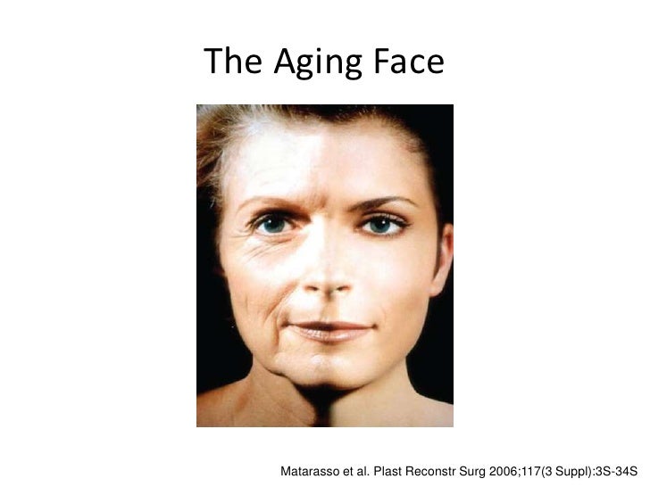 rejuvenation botox