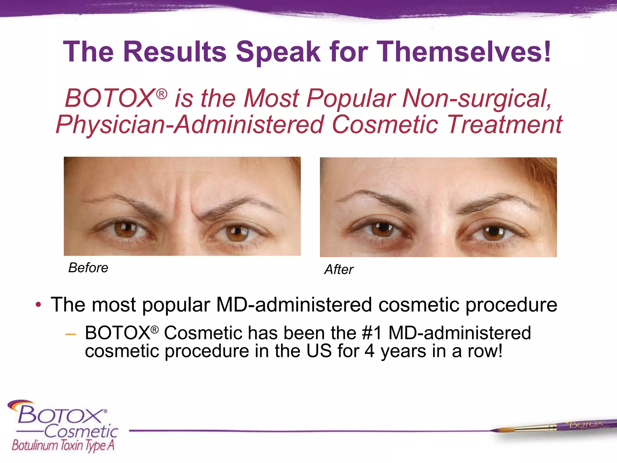 The Results Speak for Themselves! The most popular MD-administered cosmetic procedure BOTOX ®  Cosmetic has been the #1 MD-administered cosmetic procedure in the US for 4 years in a row! BOTOX   ®  is the Most Popular Non-surgical, Physician-Administered Cosmetic Treatment Before After 