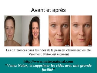 Avant et après




Les différences dans les rides de la peau est clairement visible.
                 Vraiment, Natox est étonnant

          http://www.natoxnatural.com
“Venez Natox, et supprimer les rides avec une grande
                      facilité”
 