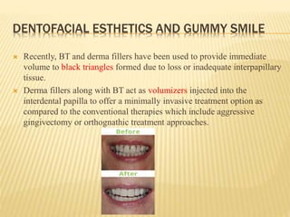 DENTOFACIAL ESTHETICS AND GUMMY SMILE
 Recently, BT and derma fillers have been used to provide immediate
volume to black triangles formed due to loss or inadequate interpapillary
tissue.
 Derma fillers along with BT act as volumizers injected into the
interdental papilla to offer a minimally invasive treatment option as
compared to the conventional therapies which include aggressive
gingivectomy or orthognathic treatment approaches.
 