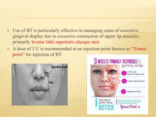  Use of BT is particularly effective in managing cases of excessive
gingival display due to excessive contraction of upper lip muscles;
primarily levator labii superioris alaeque nasi.
 A dose of 3 U is recommended at an injection point known as “Yonsei
point” for injection of BT.
 