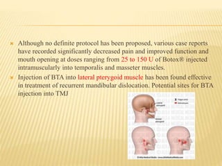  Although no definite protocol has been proposed, various case reports
have recorded significantly decreased pain and improved function and
mouth opening at doses ranging from 25 to 150 U of Botox® injected
intramuscularly into temporalis and masseter muscles.
 Injection of BTA into lateral pterygoid muscle has been found effective
in treatment of recurrent mandibular dislocation. Potential sites for BTA
injection into TMJ
 