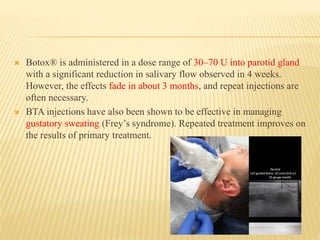 Botox® is administered in a dose range of 30–70 U into parotid gland
with a significant reduction in salivary flow observed in 4 weeks.
However, the effects fade in about 3 months, and repeat injections are
often necessary.
 BTA injections have also been shown to be effective in managing
gustatory sweating (Frey’s syndrome). Repeated treatment improves on
the results of primary treatment.
 