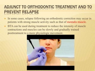 ADJUNCT TO ORTHODONTIC TREATMENT AND TO
PREVENT RELAPSE
 In some cases, relapse following an orthodontic correction may occur in
patients with strong muscle activity such as that of mentalis muscle.
 BTA can be used during treatment to reduce the intensity of muscle
contractions and muscles can be slowly and gradually trained
posttreatment to a more physiologic movement.
 