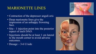 MARIONETTE LINES
• Contraction of the depressor anguli oris
• Deep marionette lines give the
impression of an unhappy frowning
face.
• Site - 1 injection point into the posterior
aspect of each DAO.
• Injections should be at least 1 cm lateral
to the mouth corner to avoid adverse
outcomes.
• Dosage – 3-6 U/side
 