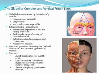 The Glabellar Complex and Vertical Frown Lines
 Glabella lines are created by the action of 3
muscles:
 the corrugator supercilli;
 the procerus;
 and the depressor superciliis.
 Before initiating the treatment,
 Assess facial expression at rest and
during animation.
 Evaluate the range of motion of
involved muscles.
 Palpate muscles during repose and
contraction.
 Assess brow position
 Injections given into the corrugator (red and
blue circles) and procerus (green circle)
muscles.
 Caution :

Avoid injecting too low over the
orbit.

Use caution with lateral brow
injections; stay well above the
superior orbital rim.

Do not completely paralyze the
muscles.

 