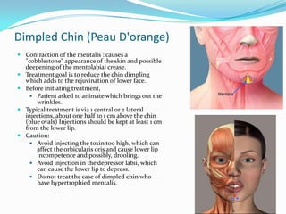 Dimpled Chin (Peau D'orange)
 Contraction of the mentalis : causes a
"cobblestone" appearance of the skin and possible
deepening of the mentolabial crease.
 Treatment goal is to reduce the chin dimpling
which adds to the rejuvination of lower face.
 Before initiating treatment,
 Patient asked to animate which brings out the
wrinkles.
 Typical treatment is via 1 central or 2 lateral
injections, about one half to 1 cm above the chin
(blue ovals) Injections should be kept at least 1 cm
from the lower lip.
 Caution:
 Avoid injecting the toxin too high, which can
affect the orbicularis oris and cause lower lip
incompetence and possibly, drooling.
 Avoid injection in the depressor labii, which
can cause the lower lip to depress.
 Do not treat the case of dimpled chin who
have hypertrophied mentalis.

 
