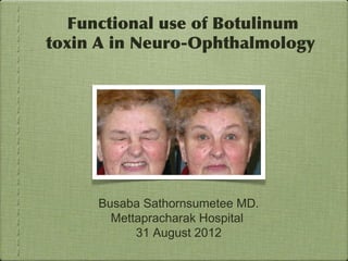 Functional use of Botulinum
toxin A in Neuro-Ophthalmology




     Busaba Sathornsumetee MD.
       Mettapracharak Hospital
           31 August 2012
 